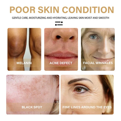 Serum visage au curcuma. Ressere les pores. Repare la mélanine, éclaircit et hydrate. Huile de curcumine nourrit pour attenuer les tâches brunes.